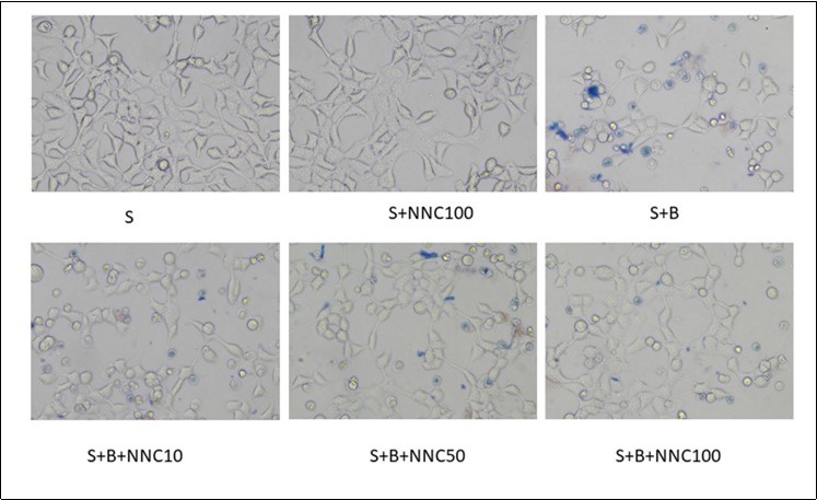 The dead cells in every group.(Trypan blue staining,200×)
