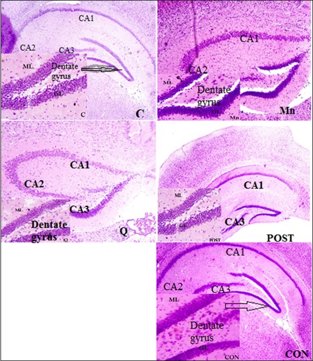Photomicrograph of the dentate gyrus (DG) section in control (C) group, manganese (Mn) group, Quercetin (Q) group, post treatment (PT) group and concurrent (PT) group. Stained with H&E. Mg x800