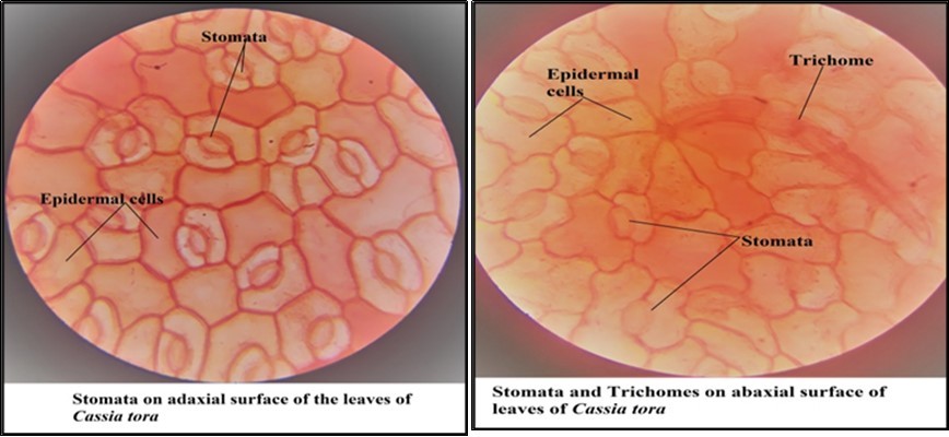 Micromorphology of leaves of Cassia tora (adaxial surface and abaxial surface)