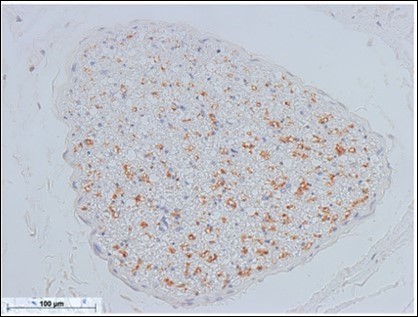 Sympathetic nerve fibers of the optic nerve (anterior facial nerve: TH staining) Bar = 100um