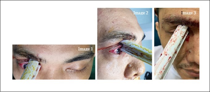 images 1-3 are that of the patient upon examination at the emergency unit.