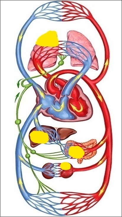 Schematic representation of the human circulatory system. Comparative value of foci of acute inflammation (yellow fields) for different departments and volumes of blood flow, depending on the possible localization.