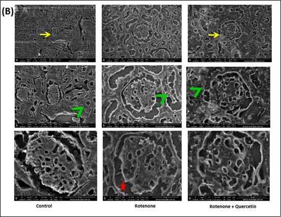 Scanning electron micrographs of kidney of rotenone and co- administration of quercetin mice . Control group showing  normal architecture of renal corpuscles with their glomeruli (Yellow arrows) and renal tubules (green arrow head). Photomicrograph of kidney treated with rotenone showing alteration in renal corpuscles (yellow arrows); degeneration of renal tubules (green arrow head), wide spacing of tubules with atrophy of their lining epithelium (red star).Photomicrograph of kidney treated with rotenone + quercetin showing normal appearance of renal corpuscles and renal tubules.