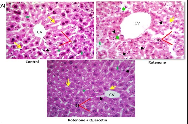 Effect of rotenone and co-treatment of quercetin and rotenone on histology of liver of mice. Control liver showing normal appearance classic hepatic strands (yellow arrows) with hepatocytes (green asterisk) of control mice separated by blood sinusoids (Bs) (red line); Central vein (CV). Rotenone  treated group, showing degranulation of hepatocytes cytoplasm, loss of hepatic strands (yellow arrows); abnormality in sinusoids (red line); shrinkage of hepatocytes ( green asterisks),Leucocytes infiltration  (green arrow head) and Kupper cells activation (black arrow head). Rotenone + quercetin treated group showing classical hepatic strands (yellow arrows); normal structure of blood sinusoids (Bs); central vein (Cv);  normal appearance  of hepatocytes ( green asterisks) and  least number of Kupper cells activation (black arrow head). Tissues sections (about 5 μm) were prepared, stained with haematoxylin and eosin (H&E). Magnification, 40×