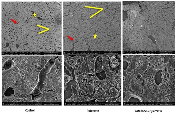 Scanning electron micrographs of liver of rotenone and co- administration of             quercetin mice . Control group showing  normal appearance of  hepatocytes strands ( red arrow), central vein (yellow star); surrounding the normal sinusoids (yellow line ), Rotenone administrated group,  shows loss of hepatic strands (red arrows);  abnormality in sinusoids (Yellow line). Rotenone + quercetin treated group showing classical hepatic strands ,normal structure of blood sinusoids , central vein  and normal appearance  of hepatocytes .Scale Bar 200 μm  and 10 μm.