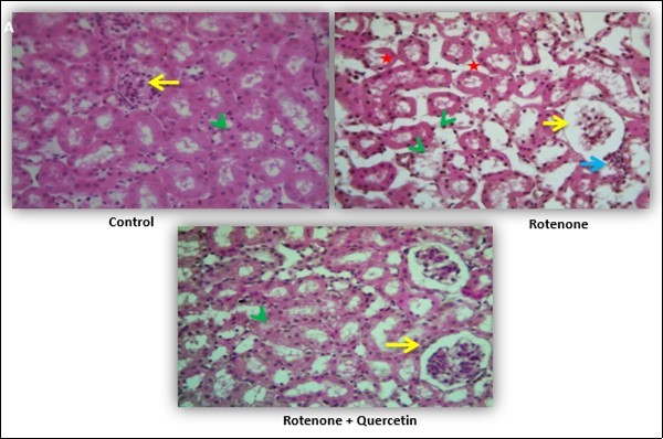 Effect of quercetin  and co-treatment of quercetin and rotenone on histological alteration of mice  kidney following exposure to rotenone.(A) Control group showing  normal architecture of renal corpuscles with their glomeruli (Yellow arrows) and renal tubules (green arrow head).               Photomicrograph of kidney treated with rotenone showing alteration in renal corpuscles (yellow    arrows); degeneration of renal tubules (green arrow head) and necrosis and wide spacing of                tubules with atrophy of their lining epithelium (red star), focal interstitial chronic inflammation              infiltration of lymphocytes and mononuclear cell interstitium (blue arrow).  Photomicrograph of             kidney treated with rotenone + quercetin showing normal appearance of renal corpuscles and renal tubules. Kidney tissue sections were stained with hematoxylin and eosin method (40x).