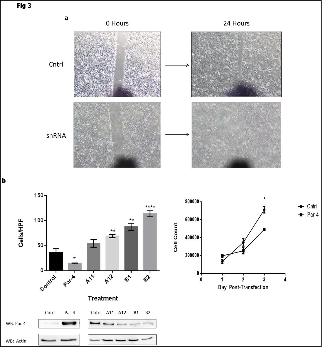 Par-4 inhibits migration in SW480 cells. a) Scratch assays were performed to compare the ability of mock- and anti-Par-4 shRNA-transfected cells to migrate in 24 hours. A representative image of the scratch at the 0 and 24 hour timepoint is shown. b) SW480 cells that were transiently transfected with either Par-4 expression plasmid, anti-Par-4 shRNA (A11, A12, B1, and B2), or empty vector were cultured in media with 1% FBS in the inner chamber of a Boyden chamber, while media with 10% FBS in the lower chamber acted as a chemoattractant. Cells are allowed to migrate for 24 hrs, then the number of migrated cells were quantitated (# cells/high-powered field). Data shown are the means ± SE of five random fields. Western blots confirming the overexpression and knock-down of Par-4 levels are also shown. c) Cell proliferation was assessed by counting viable cells in trypan blue assays. Data shown are means ± SE of at least two replicates.