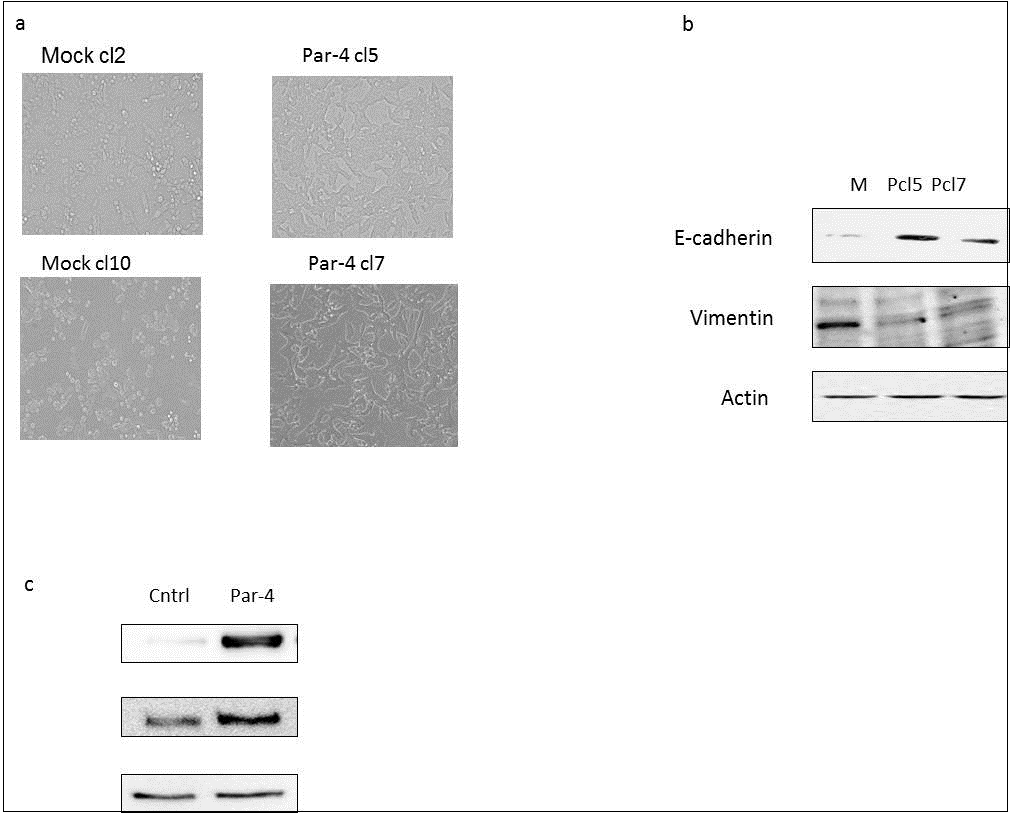 Par-4 induces a mesenchymal-epithelial transition in SW620 cells. a) Phase-contrast microscope images of mock and Par-4-transfected SW620 cells were collected, and b) lysates were processed for Western blot analyses of E-cadherin, the mesenchymal marker, vimentin, and actin. c) SW480 cells were transfected with Par-4 and western blot analyses were performed for Par-4, E-cadherin, and actin.