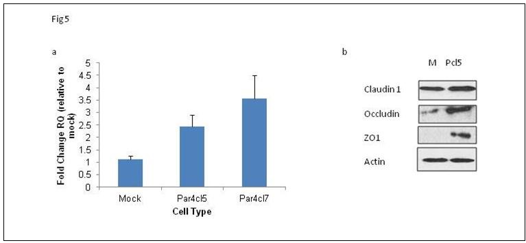 Par-4 induces E-cadherin transcription and tight-junction protein upregulation. a) RT-PCR analyses for E-cadherin mRNA expression in mock and Par-4-transfected cells were performed. The bars in the graph reflect the fold upregulation of E-cadherin mRNA expression in Par-4-transfected cells over the expression in mock-transfected cells. Data shown are means + SE of three biological replicates. b) Western blot analyses for tight junction proteins, claudin 1, occludin, ZO-1, and actin were performed.