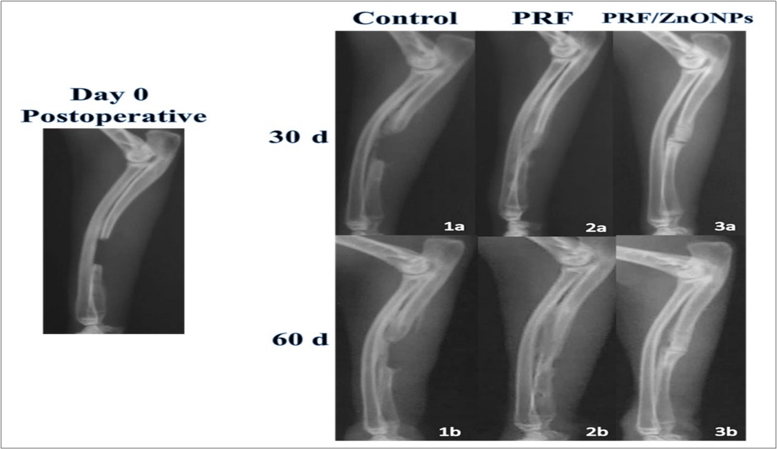 Showing lateral radiographs of the three experimental groups (Control, PRF and PRF/ZnONPs) at 0, 30 and 60 postoperative days.