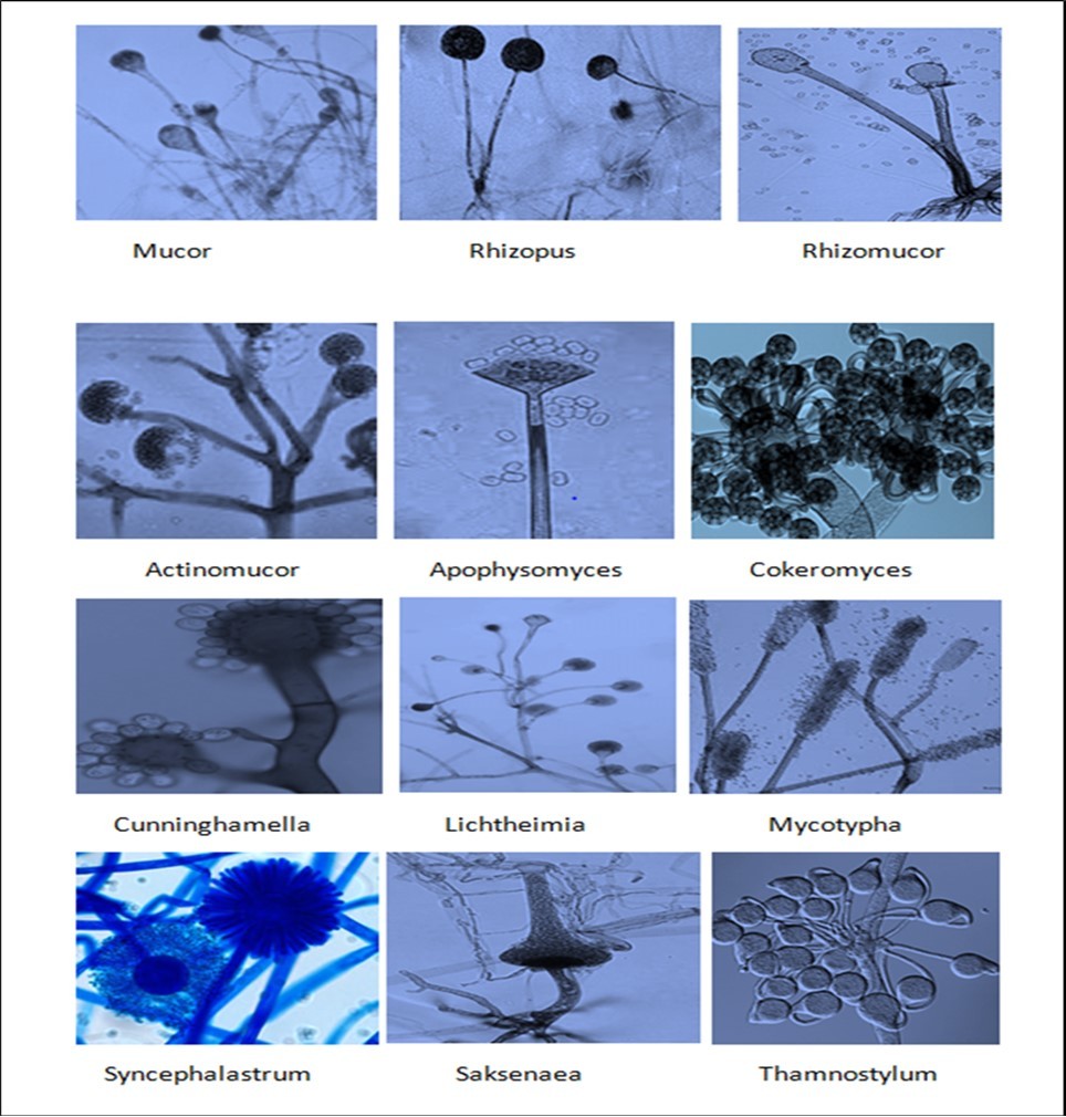 Important genera of Mucorales causing Mucormycosis in human.