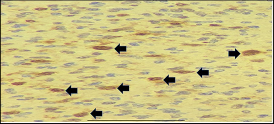 Immunohistochemistry staining results. S-100 shows selective staining of the cells of interest (black arrows).