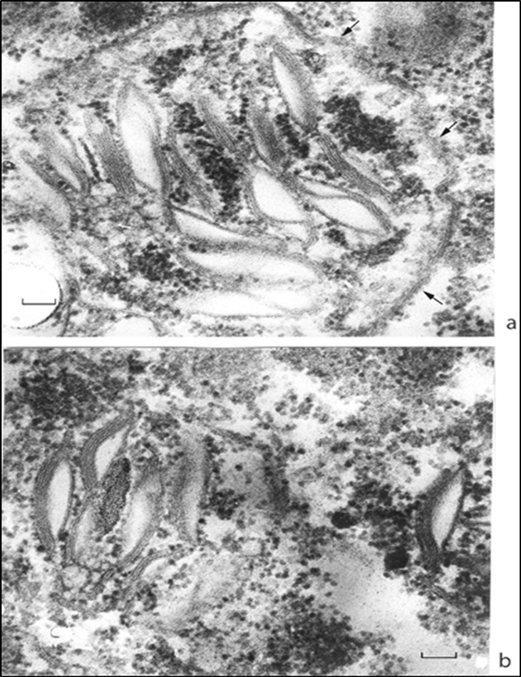 Juvenile chloroplasts at high magnification. (a) Stacks of granal thylakoids are enclosed with an incompletely formed envelope; (b) are envelope-free. Cytoplasmic ribosomes make a common field both inside and outside the body of a chloroplast. Envelope fragments are shown by arrows. Scale bar,                   0.1 mm.