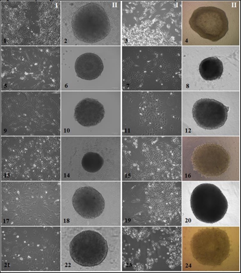 Мorphology of the established solid tumor cell cultures and spheroids I-monolayer tumor cell cultures, II-spheroids composed of tumor cells (monospheroids). 1, 2 – alveolar sarcoma #927, 10 passage; 3, 4 – melanoma #860, 35 passage; 5, 6 – leiomyosarcoma #699, 16 passage; 7, 8 – melanoma #912, 25 passage; 9, 10 – rhabdomyosarcoma #862, 20 passage; 11, 12 – melanoma #929, 51 passage; 13, 14 – synovial sarcoma #716, 25 passage; 15, 16 – renal cancer #584, 40 passage; 17,  18 – myxofibrosarcoma #728, 19 passage; 19, 20 – colon cancer #485, 12 passage; 21, 22 – osteosarcoma #921, 12 passage; 23, 24 – bladder cancer #875, 15 passage.                Inverted microscope, phase contrast, 100 µm scale value.