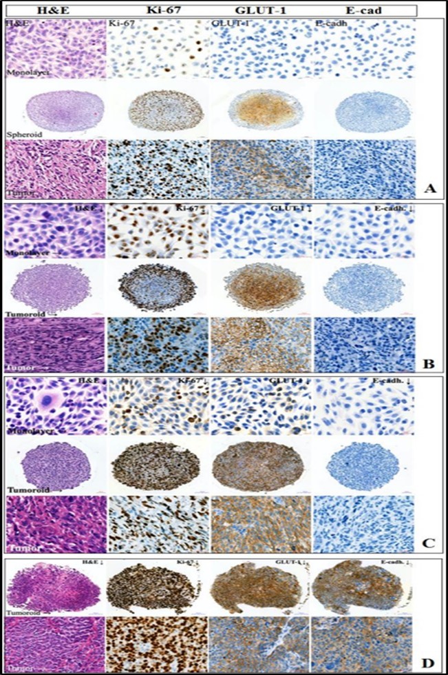 Identification of Ki-67, GLUT1, E-cadherin in solid tumor cells from different experimental systems. A - #921 osteosarcoma, 10             passage, spheroid ⊘ 752.7 μm; B - #912 melanoma, 19 passage, ⊘ 683 μm; C - #982 myxofibrosarcoma, 33 passage, ⊘ 611.8 μm; D - #973 breast cancer, 27 passage, ⊘ 690 μm. Monolayer culture - 20 μm scale bar; spheroid - 100 μm scale bar; tumor tissue - 20 μm scale bar. From left to right: hematoxylin-eosin staining; proliferative activity marker Ki-67; GLUT1 - glucose transporter protein; cell adhesion protein                  E-cadherin.  different experimental systems.