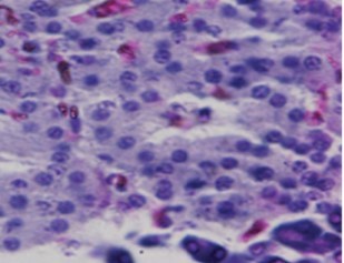 Normal Photomicrograph of the pancreas from a non-diabetic healthy rat demonstrating normal histoarchitecture (H &E stain X400             magnification)