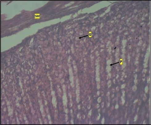 Image of a wistar rats stomach treated with high dose of abelmoschus esculentus showing dysplasia of gastric pits with the arrows mark (p). Goblet cells mark with arrow (g) appear at the basal mucosa and smooth muscle (sm) appear mildly            eroded. The slide was stained using h & e technique. X100