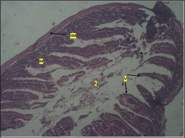 Low dose showing numerous epithelial cells in the mucosa (m) with villi projecting towards the lumen (l). The is focal metaplasia of the mucosal cells with villous disruption. smooth muscle layer              appears normal.  H & E. X40