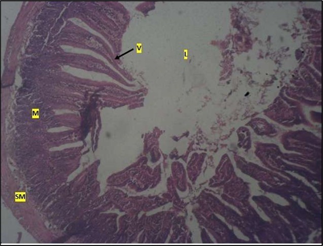 High dose showing a normal mucosa (m) with villi (v)                 projecting towards the lumen(l) and underlying smooth muscle layer (sm). No pathology seen