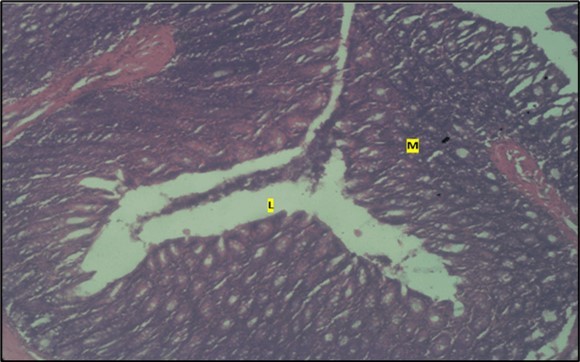 Control showing the lumen (l), the epithelial cells              lining the mucosa (m) appearing normal H & E. X40.