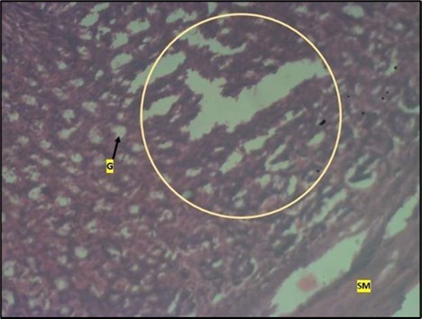 Image showing deep epithelial gastric pit area with marked depletion of pits and goblet cells (circled area). Smooth muscle (sm) appears                    normal in animals treated with Low dose of                Abelmoschus esculentus stained with H & E             technique X100