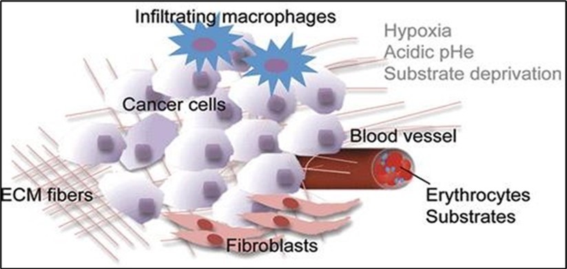 Infiltrating macrophages of cancer cells in interaction with hypoxia acidic pHe substrate deprivation.