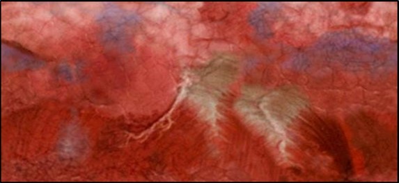 Sample heart texture image