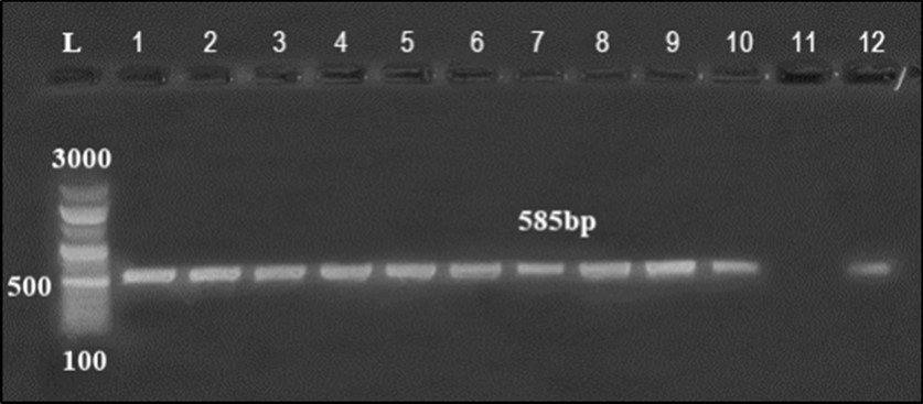 Agarose gel electrophoresis showing amplification of hly gene (450bp) Lane 1-6, 9, 10  positive samples. Lane 7, 8, 11-14: negative samples.