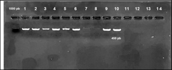 Agarose gel electrophoresis showing amplification of hly gene (450bp) Lane 1-6, 9, 10  positive samples. Lane 7, 8, 11-14: negative samples.