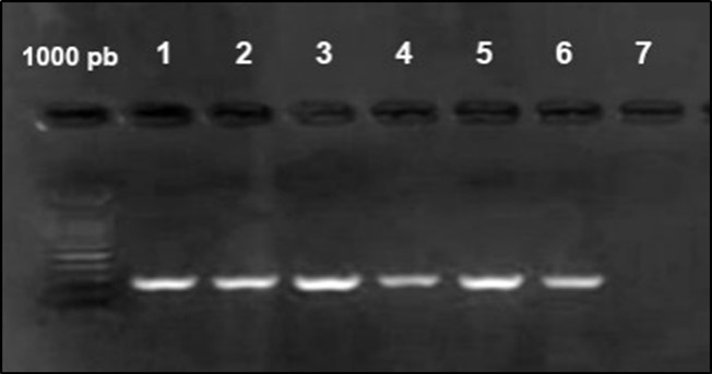 Agarose gel electrophoresis showing amplification of iut Agene (302bp) Lane 1-6:  positive samples. Lane 7 negative samples.