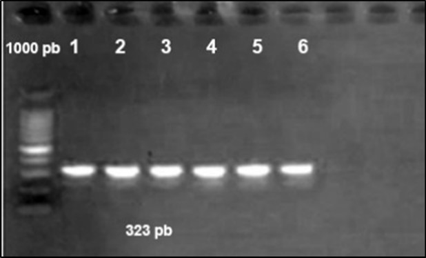 Agarose gel electrophoresis showing amplification of issgene (323bp) Lane 1-6:  positive samples. Lane 7,8: negative samples.