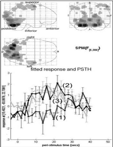 Fitted response and PSTH in dorsal visual pathway. The average response to an event type with mean signal +/- SE for each peri-stimulus time bin. Response of condition 2 (2) and 3 (3) was higher than condition 1 (1) in dorsal visual pathway (P<0.05).