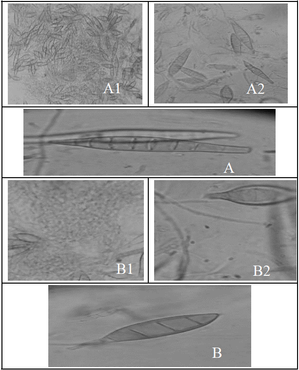 Microscopic examination of dermatophytes A) Macroconidia of Trichophyton Mentagrophytes (lactophenol cotton blue) detected from diseased animal (A1: 10x; A2: 40X; A3: 100X). B) Macroconidia of Microsporum canis (lactophenol cotton blue) detected from diseased animal (B1:10X; B2:40X; B3:100x).