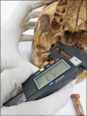 Measurement of vertical length