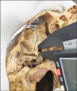 Measurement of Horizontal length