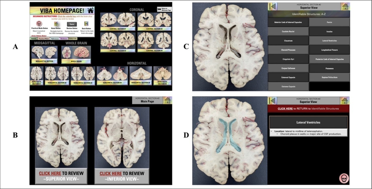 VIBA Plastinated Brain Review Mode: Homepage. (A) Review Mode Homepage. (B) The main page of the brain section. (C) List of identifiable terms for brain section. (D) Reviewed structure.