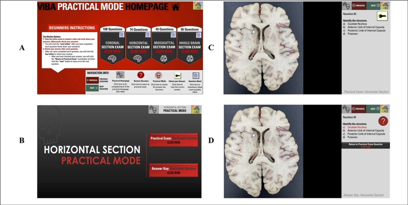 VIBA Plastinated Brain Practical Mode. (A) Practical Mode Homepage. (B) The main page of the practical mode  section. (C) Question. (D) Answer Key