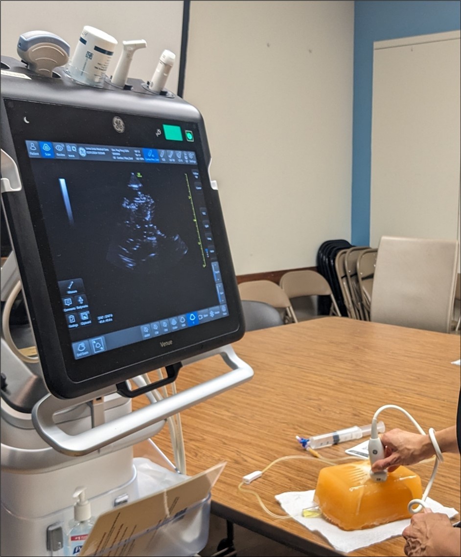 Showing the pericardial effusion from the subcostal view under ultrasound guidance