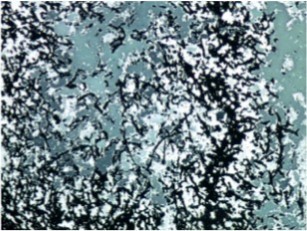 Grocott stain with filamentous branching bacteria at 10x magnification