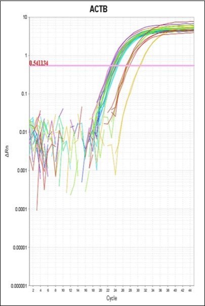 Photography of Amplification Plot of housekeeping gene ACTB