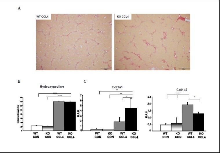 Figure 7. PNPLA3 does not mitigate nor worsen CCl4 induced hydroxyproline and collagen gene expression. Fig7A&B. Sirius Red staining and hydroxyproline measurement showed that WT and Pnpla3 KO mice had similar degrees of fibrosis upon CCl4 injection. Fig7C: Col1a1 expression increased more in Pnpla3KO upon CCl4, when Col1a2 expression was reduced compared to WT mice.