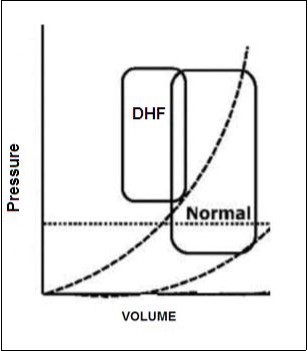 Deflection curve of volume/pressure ratio in heart failure by diastolic