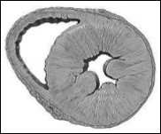 Model of concentric left ventricular hypertrophy, common in HFpEF.