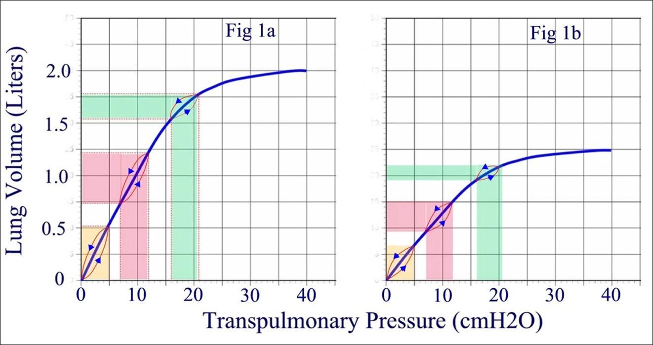 Schematic representation of the Pressure-Volume relationship in the lung. Zero on the Y-axis represents lung volume at the end of normal expiration and zero on the X-axis represents the transpulmonary pressure at the end of normal expiration. The solid blue line represents the static relationship while the red loops represents the dynamic changes during tidal inhalation and exhalation while breathing against different expiratory resistances. Slope of the line is lung compliance (∆volume/ ∆Pressure), which remains linear until the pressure exceeds 16 cmH2O above the pressure at FRC.