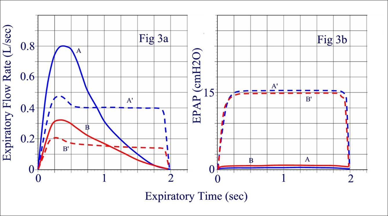 a: Exhaled flow profile during one breath in an adult that has a large tidal volume compared to an adult with a smaller tidal volume. When optimum expiratory resistance is used, the flow profile changes but the area under the curve remains unchanged in both individuals, indicating the exhaled tidal volume remained unchanged. Figure 3b: The pressure profile during expiration in the two adults in panel a. The maximum pressure in both adults is about same despite the difference in tidal volume.