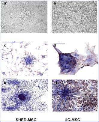 Immunohisto chemical staining for DSPP of SHEDs (A,B) and UC-MSCs (C,D). In this case the figure shows positivity for DSPP of SHEDs (A,B) and UC-MSCs (D) differentiated with the same formula at the 21st day. The data obtained in the negative control from UC-MSCs (4C) is reported, with the exclusion of contact with the primary antibody, replaced instead with normal non-immune serum.