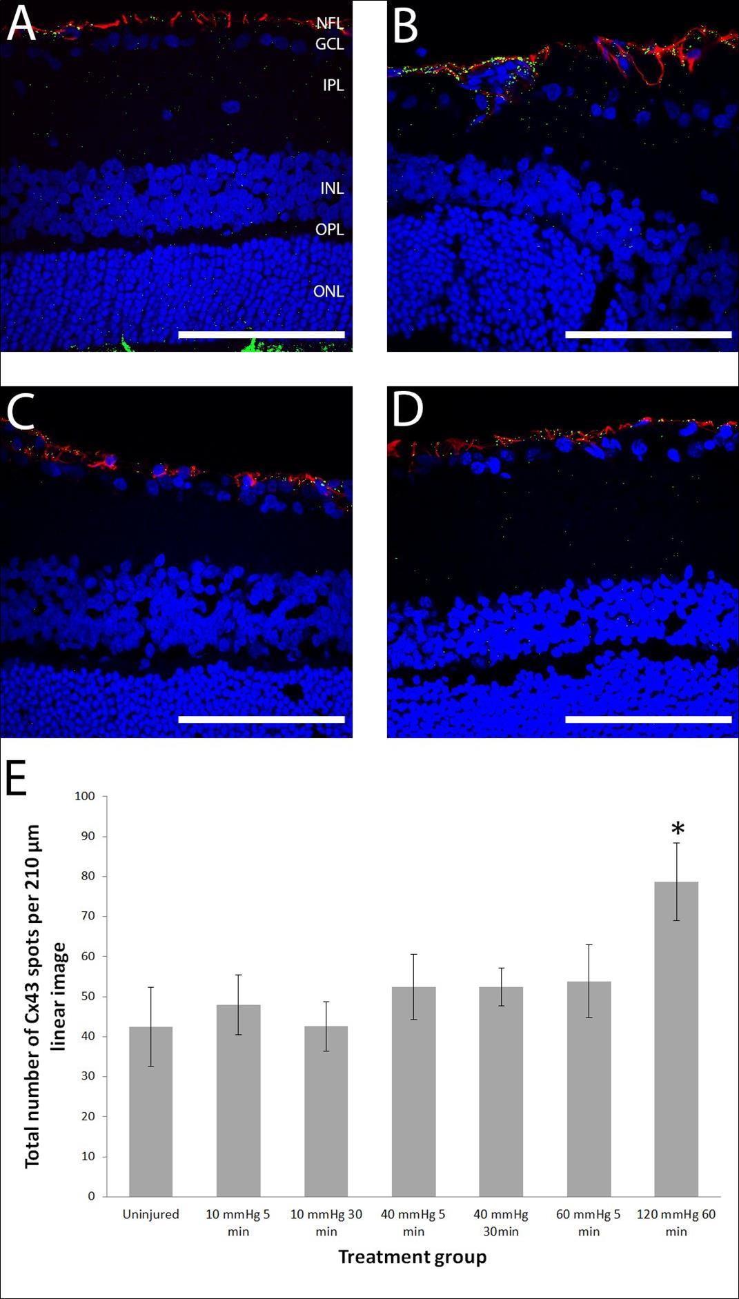 Representative confocal microscope single optical slice images of retina sagittal sections labelled for Cx43 (green), GFAP (red), and DAPI for nuclei (blue) and graphed Cx43 spot counts. (A) An uninjured retina showing regular glial processes labelled with GFAP in the NFL and Cx43 dots with some co-localisation in the same layer (resulting in yellow label). (B) A retina 14 days after 120 mmHg 60 minute manipulation shows reactive glial processes (red) and an increased amount of Cx43 label. (C) Retinas 14 days after 40 mmHg 30 minute and (D) 60 mmHg 5 minute manipulations did not change the number of Cx43 immunoreactive labelling spots or cause astrocytosis in the retina after 14 days. Scale bar = 100 µm. (E) Graph showing Cx43 spot counts in the NFL/GCL/IPL. n=6, 5, 5, 10, 10, 10, 5 for each group from left to right.
