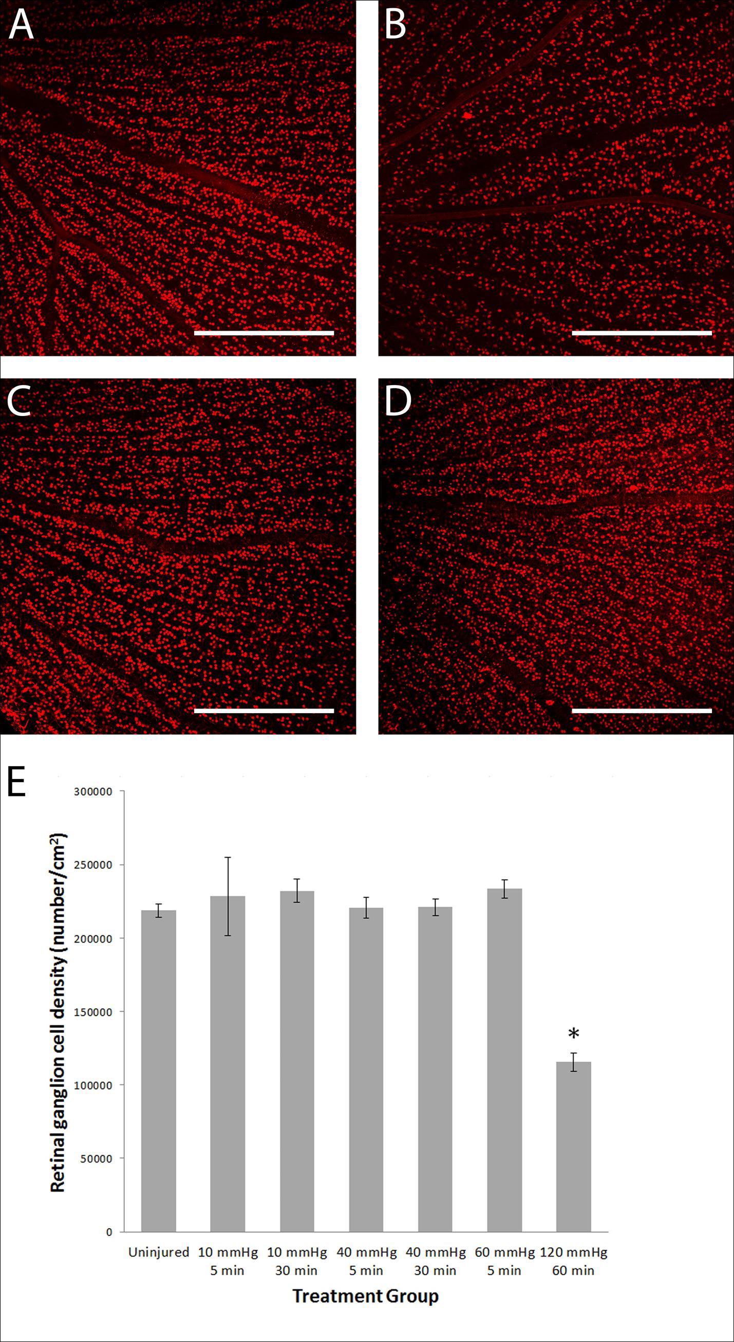 Graphed results displaying RGC density 14 days post raised intraocular pressure and confocal microscope single optical slice images of flat mounted retinas with Brn3a labelled RGCs. (A) Average RGC density 14 days after transient raised intraocular pressure. *A significant decrease was found in the group subjected to 120 mmHg intraocular pressure for 60 minutes compared to the uninjured group. n = 5, 3, 5, 10, 8, 10, 5 for each group from left to right. Images shown (B-E) were taken from the superior periphery of the retina (B) An uninjured retina is seen with densely packed RGCs. (C) A retina 14 days after 120 mmHg 60 minute manipulation had a reduced RGC density. (D) 40 mmHg 30 minute and (E) 60 mmHg 5 minute manipulations did not reduce RGC density. Scale bar = 500 µm.