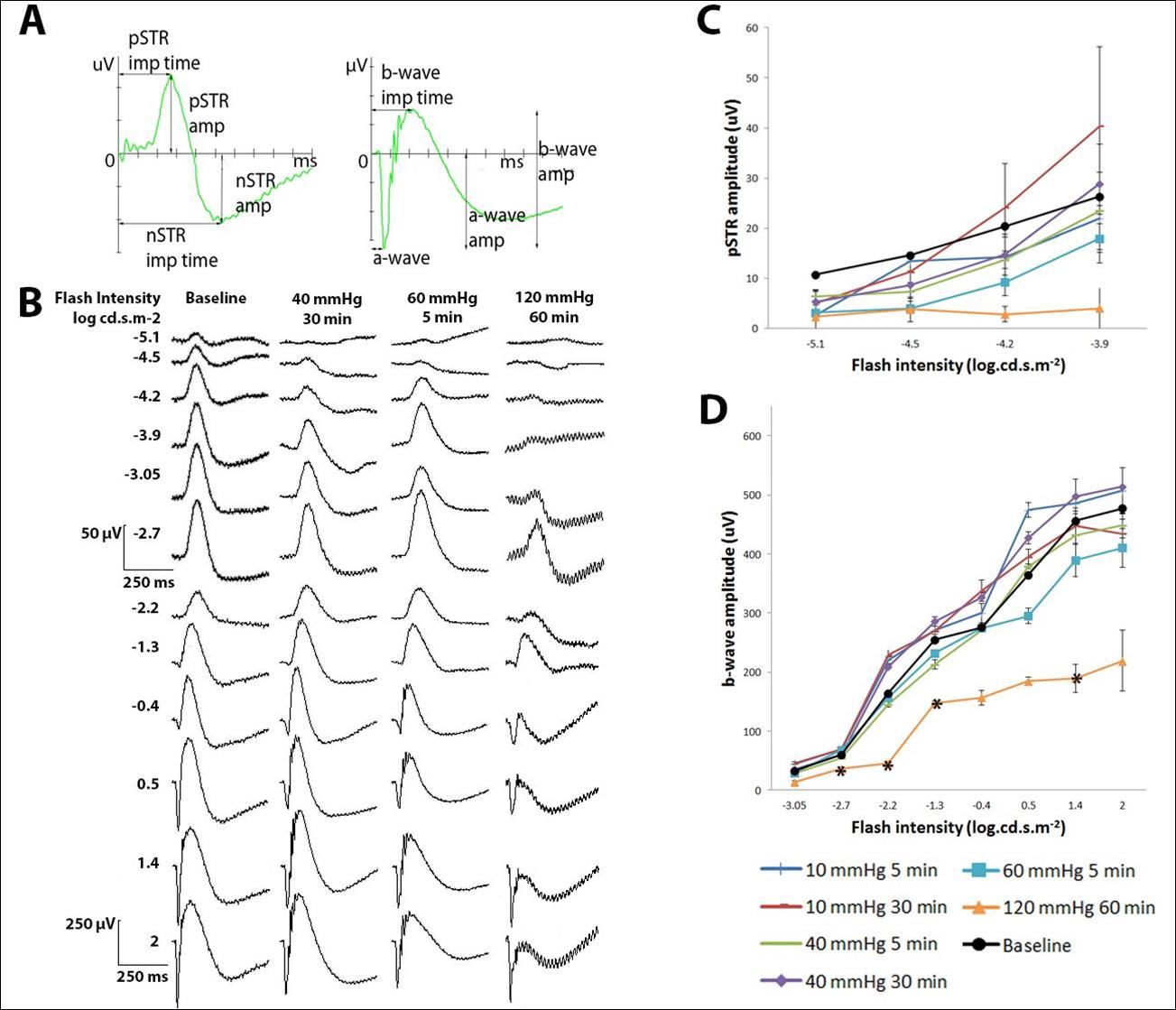 Full-field ERG findings 14 days after a transient IOP increase. (A) Graphs showing how the various measurements were read from an ERG recording. pSTR amplitude and implicit time were measured from the baseline (0 µV and 0 ms) to the peak. nSTR amplitude and implicit time were measured from the baseline to the trough. a-wave amplitude and implicit time were measured from the baseline to the trough. b-wave amplitude was measured from the trough of the a-wave to the peak of the b-wave. b-wave implicit time was measured from the baseline to the peak. (B) Examples of ERG waveforms in the scotopic threshold range (first 4 rows) and the b-wave range (last 8 rows). pSTR amplitudes (C), and b-wave amplitude (D) measured 14 days after transiently raised IOP for different durations. Data from all cannulated eyes recorded before cannulation was pooled to give a representation of baseline pSTR or b-wave amplitudes at different flash intensities (black lines). * indicates significant differences compared to baseline at the particular flash intensity at a significance level of 0.025. (C-D) 10 mmHg 5 min n=5, 10 mmHg 30 min n=5, 40 mmHg 5 min n=10, 40 mmHg 30 min n=10, 60 mmHg 5 min n=9, 120 mmHg 60 min n=4, Baseline n=43. Error bars represent SEM.
