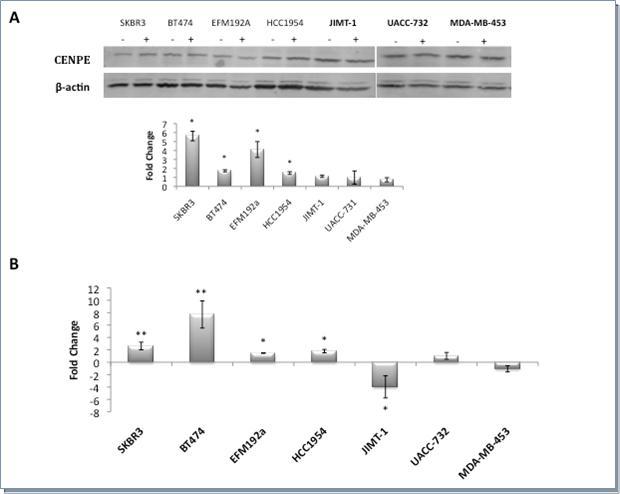 Expression of CENPE, in the absence (-) or presence (+) of 1µM lapatinib after 12 hours, in lapatinib sensitive cell lines and lapatinib insensitive cell lines (highlighted in bold). A) By western blot including densitometric measurement of protein fold change (control vs. Lapatinib treated). B) qRT-PCR measurement of expression changes of mRNA (control vs. Lapatinib treated) * represents significance at p<0.05 ** at p<0.01 by Students t-test